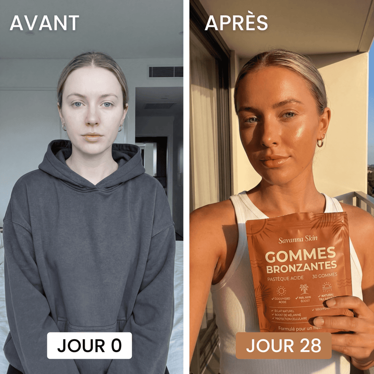 Avant / Après cliente Verdène