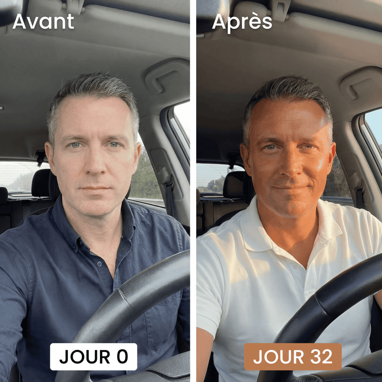 Avant / Après client Verdène