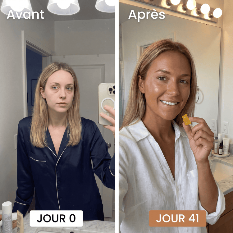 Avant / Après cliente Verdène