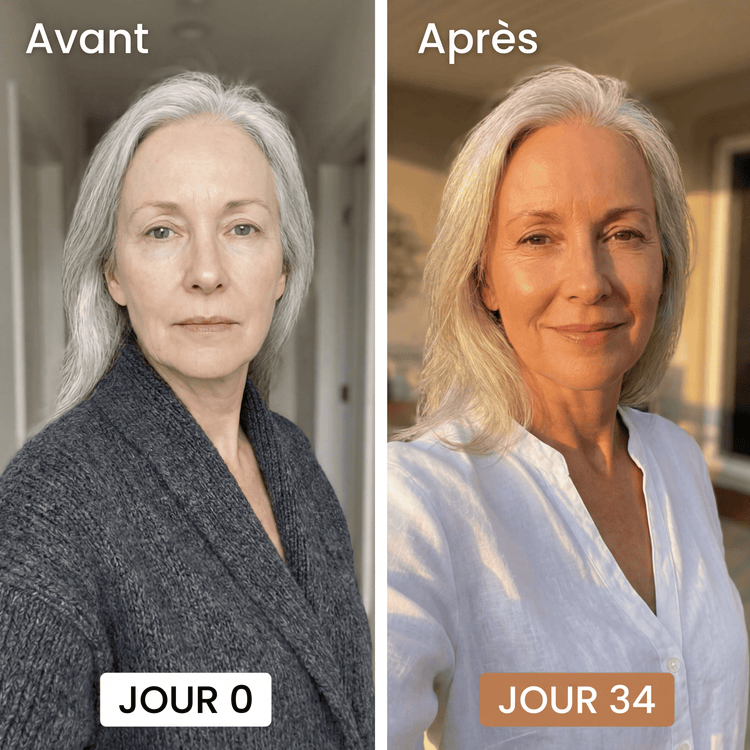 Avant / Après cliente Verdène